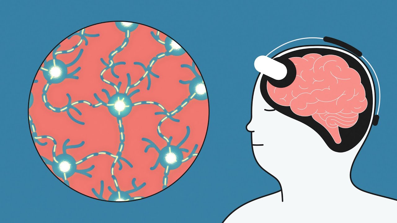 Cargar video: Vídeo explicativo de Flow Neuroscience, en inglés.